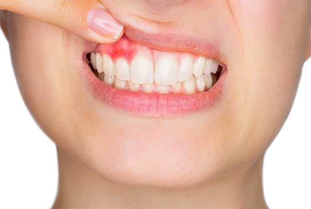 歯をまもる歯科の歯周病治療の特徴